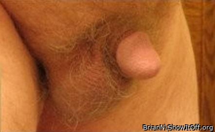 Photo of a private part from BrianN