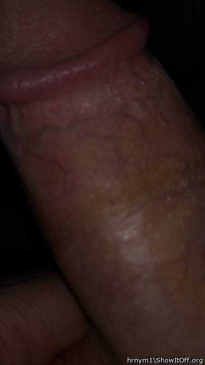 Photo of a short leg from hrnym1