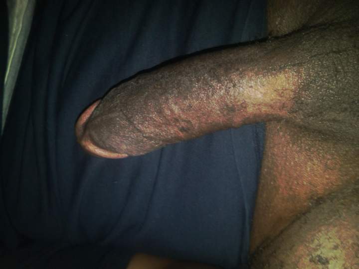 Photo of a schlong from GaryMPLS72