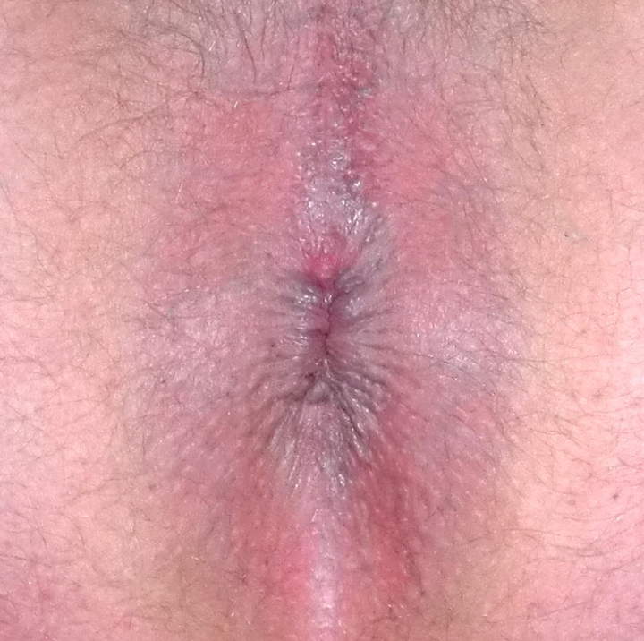 Photo of Man's Ass from Mitrandir