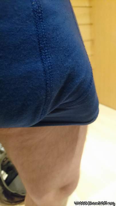 Photo of a short leg from tiit666