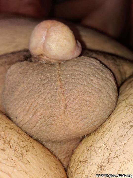 Photo of a short leg from M*C*S