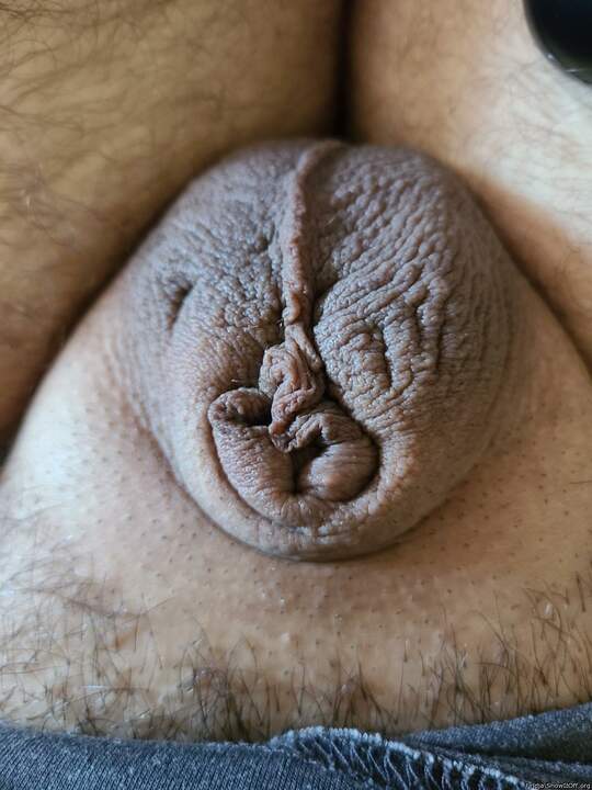 amazing foreskin 