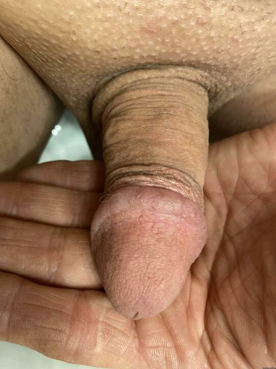 This dick would be nice with the foreskin circumcised!! Beau