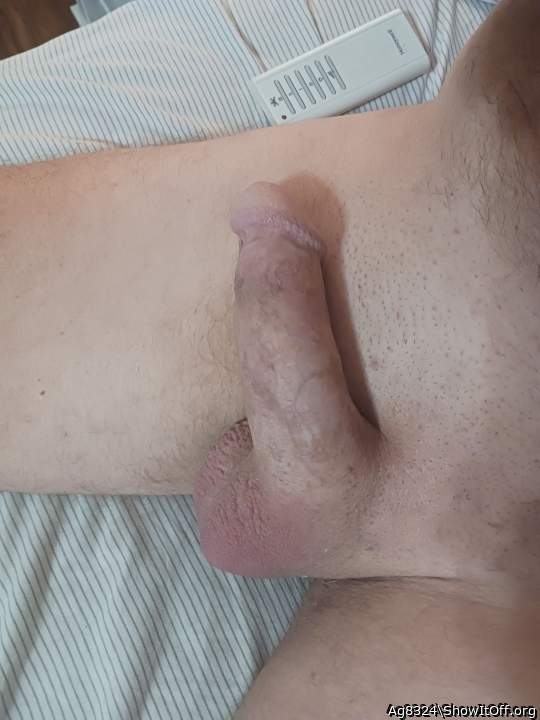 Photo of a short leg from Ag8324