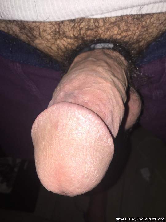 Photo of a middle leg from jimes104