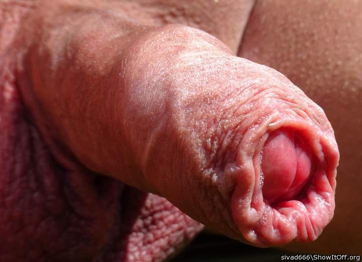 Photo of a prick from sivad666