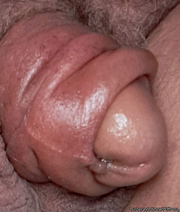 Knobby
