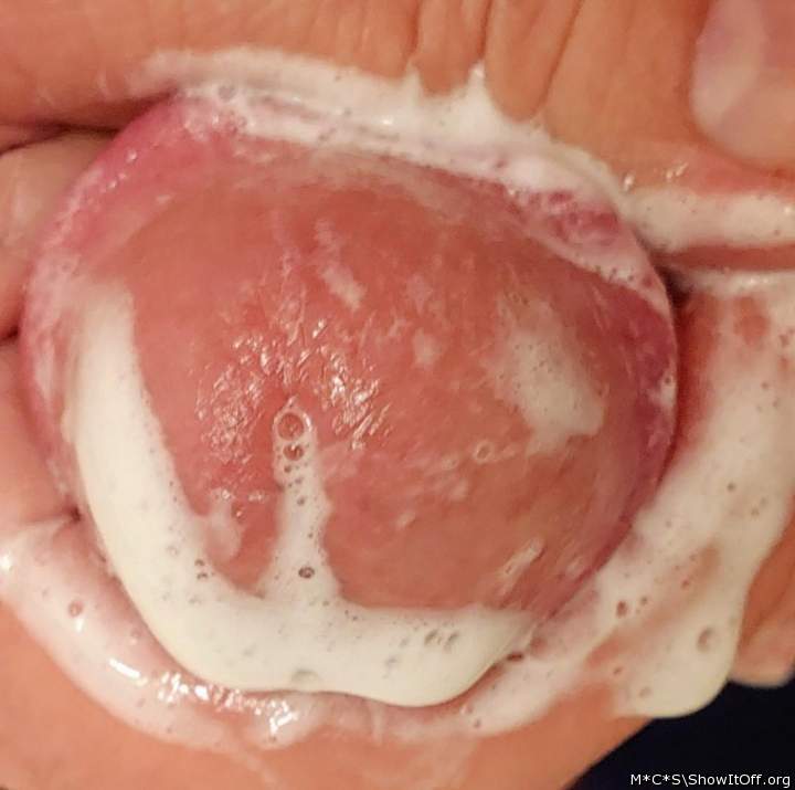 Photo of a private part from M*C*S