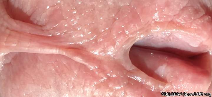 Notice how the frenulum doesn�t entirely align with the hole!