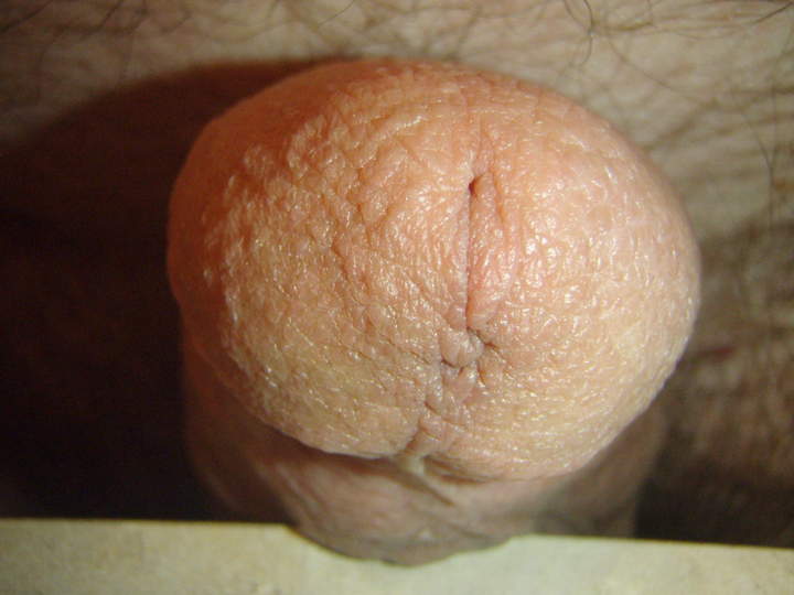 HI