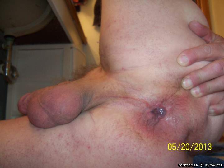 Balls and butt.  Take your choice