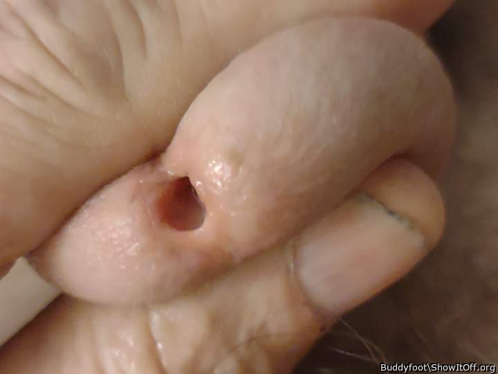 #close up #gland