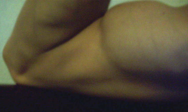 my tennisball sized bicep