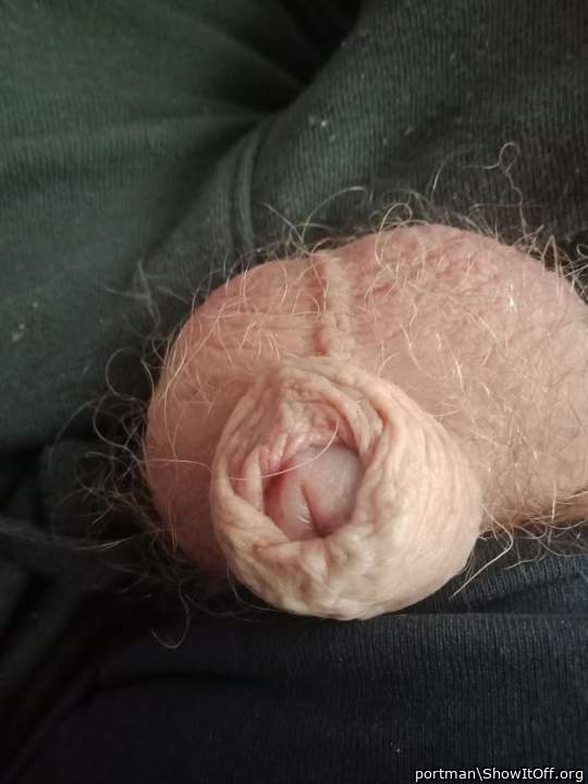 Hairy balls