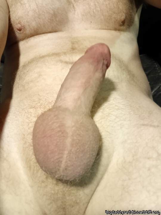 Photo of a short leg from Bigdaddyred