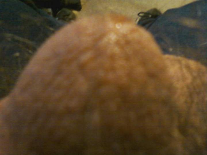 Testicles Photo from rkf