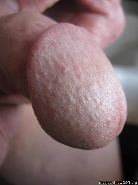Beautiful glans.....