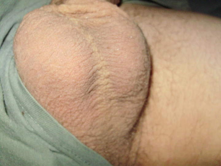 tight sack