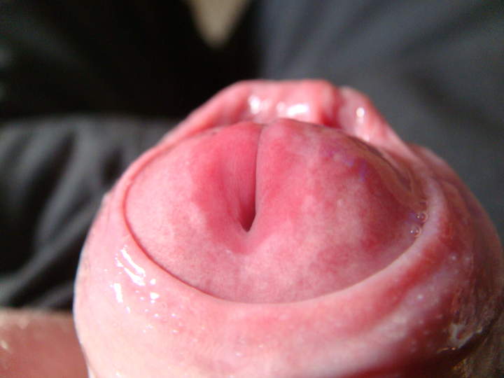 Photo of a short leg from sivad666