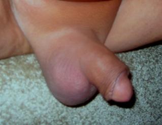 Fat Balls, Tiny Dick