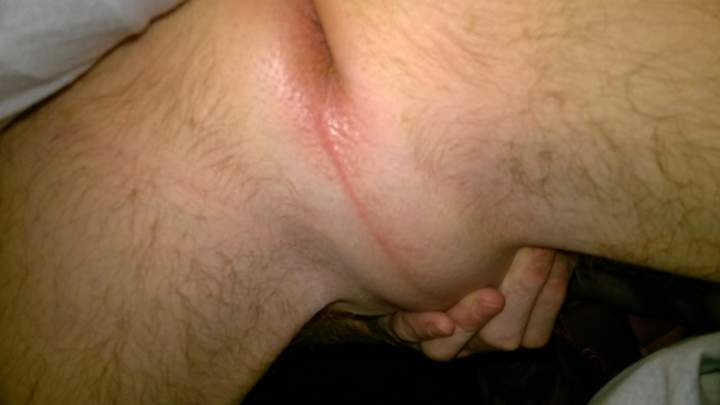 Photo of a penile from mack101