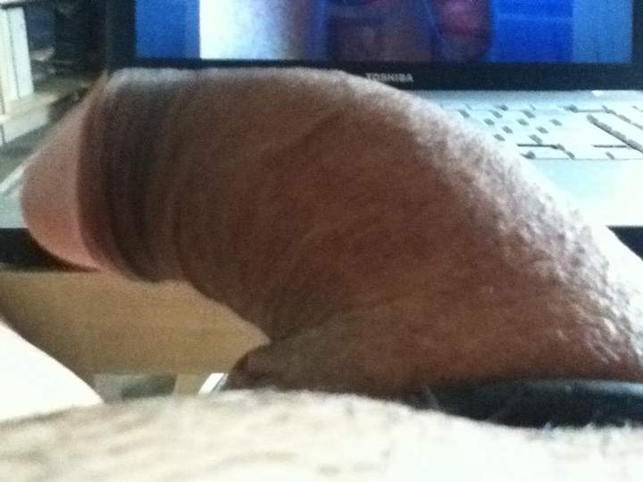 Photo of a prick from oralwerk