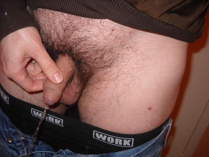 Photo of a short leg from phil