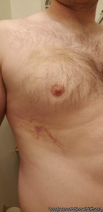 got some fun sex bruises!