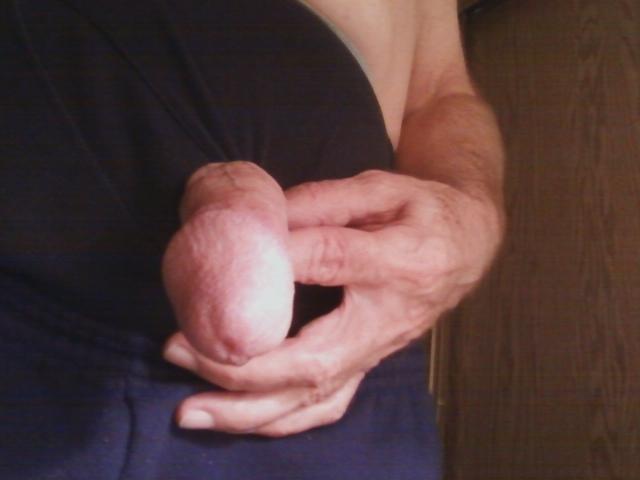 Photo of a short leg from iduda2003