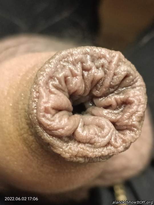 pretty foreskin