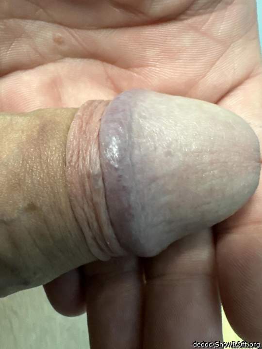 Photo of a schlong from dedoc