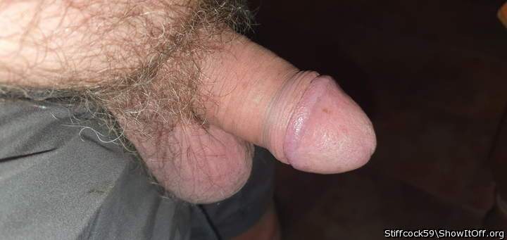 MY GLANS
