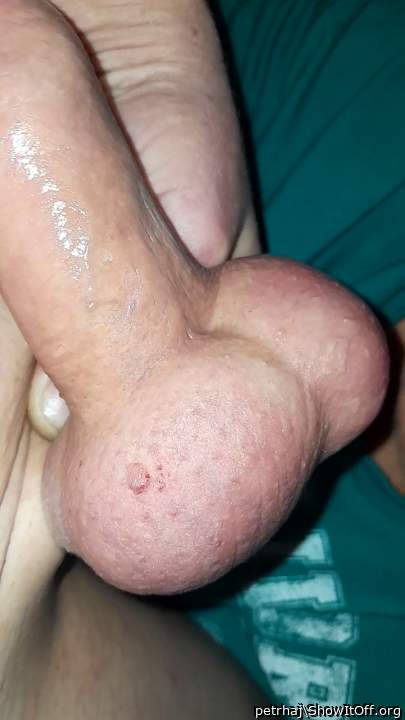 my balls foto