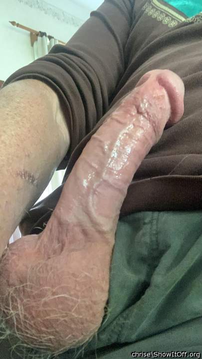 Photo of a penile from chrise