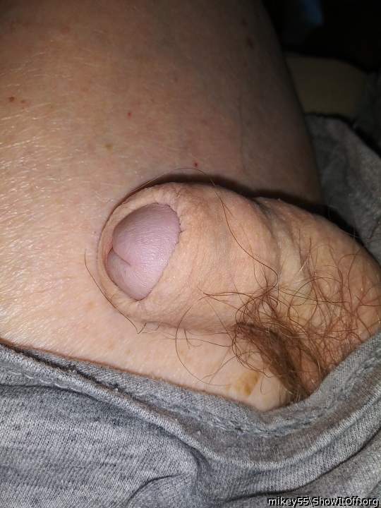 Foreskin