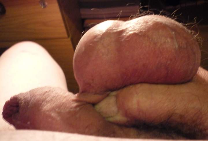 lovely hairy balls