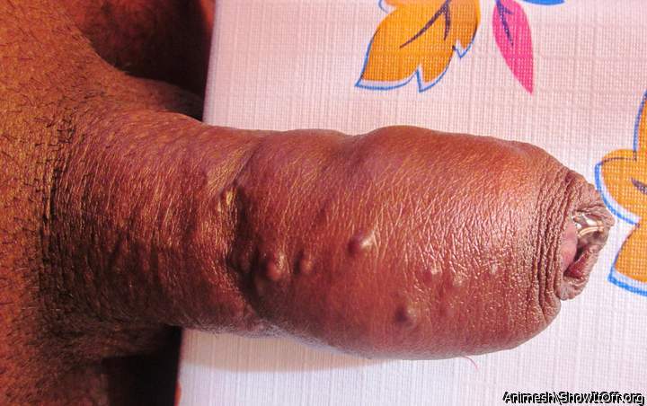 Dick tied for 3 hours