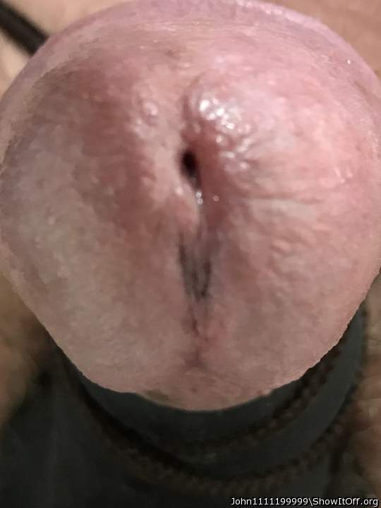 Photo of a private part from John1111199999