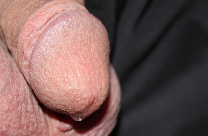 Photo of a middle leg from lilsoftee