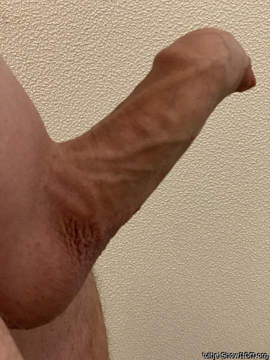 Phimosis shaved