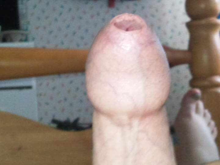Open your foreskin fully please