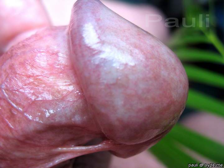 Glans macro