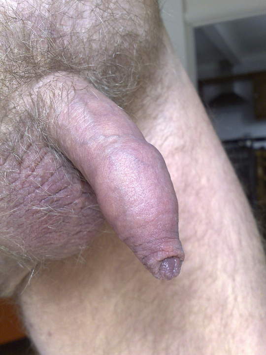 Photo of a snake from X5TANNED