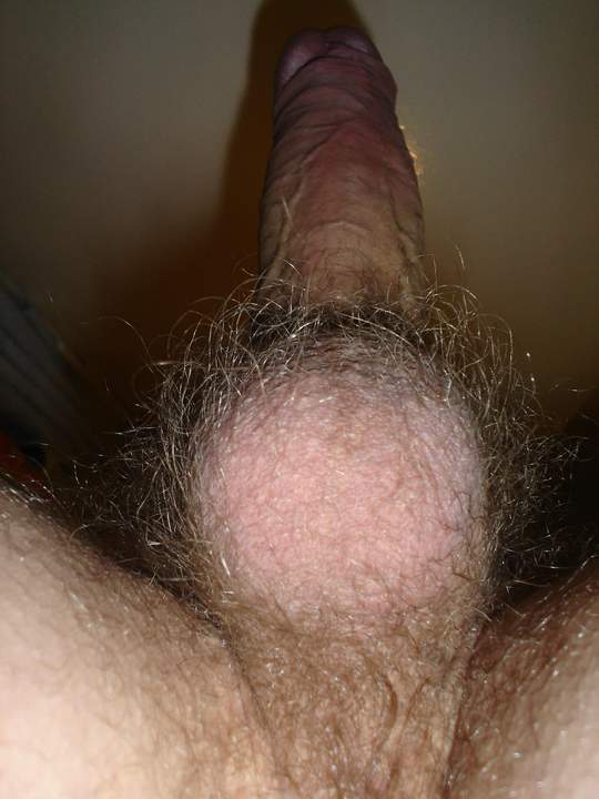 Hairy balls