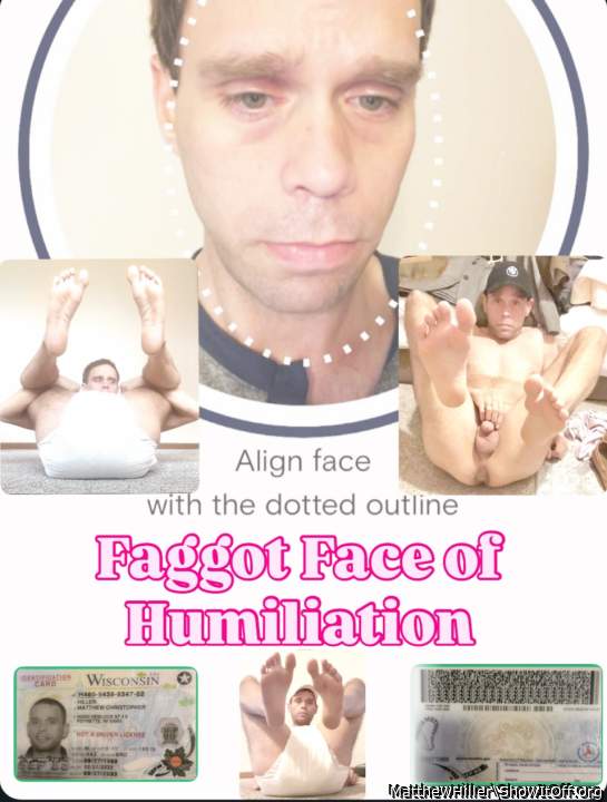 Humiliated Gay Bottom with Tiny Nub Penis