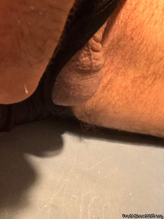 Testicles Photo from Fradi