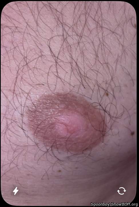 Nipple