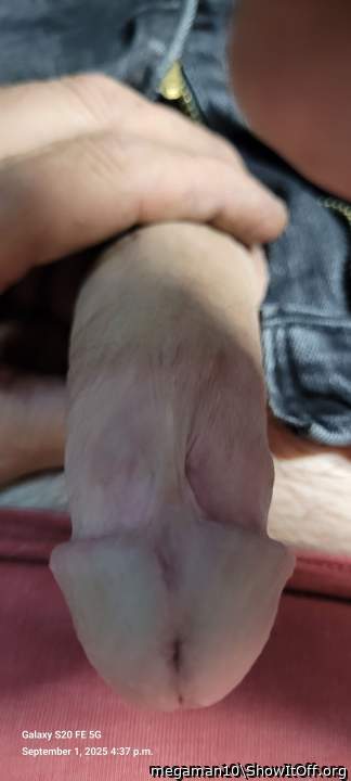 Photo of a penile from megaman10