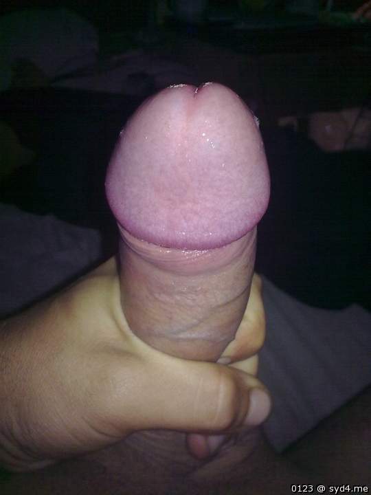 Photo of a penile from 0123